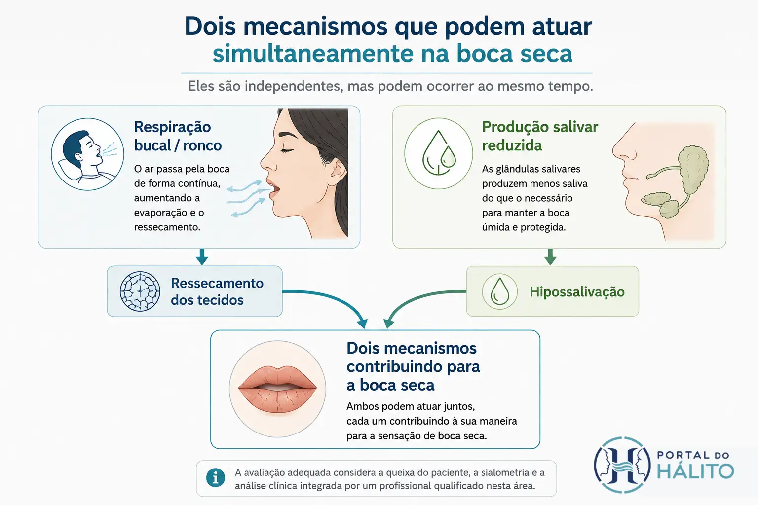 Infográfico com dois caminhos independentes para a boca seca: respiração bucal ou ronco levando ao ressecamento dos tecidos e produção salivar reduzida levando à hipossalivação; os dois mecanismos podem atuar simultaneamente.