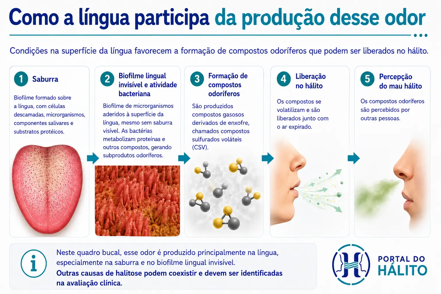 Infográfico mostrando como saburra e biofilme lingual invisível participam da formação de compostos sulfurados voláteis e da percepção do mau hálito.